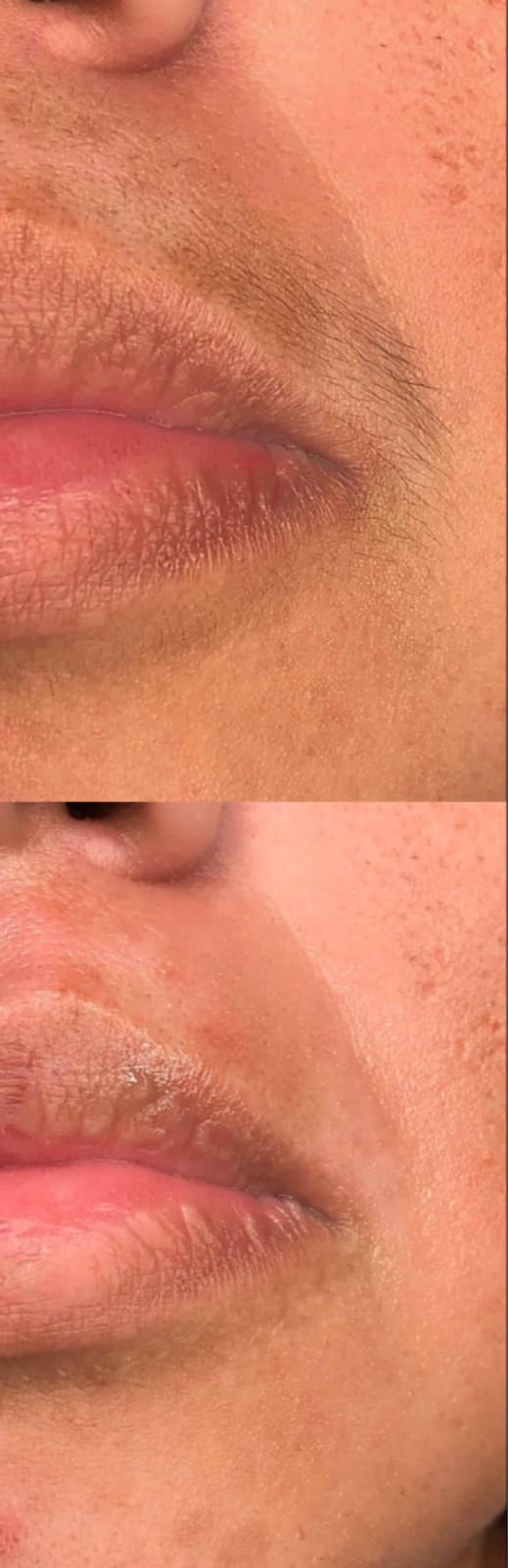 Herbal Wax Powder -Kojagari Hair Removal | Instant | Painfree | For Women and Men | 100 Gm | photo review