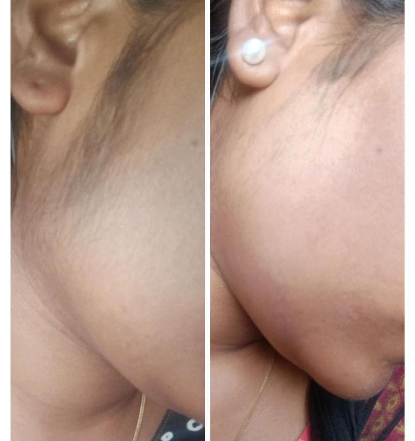 Herbal Wax Powder -Kojagari Hair Removal | Instant | Painfree | For Women and Men | 100 Gm | photo review